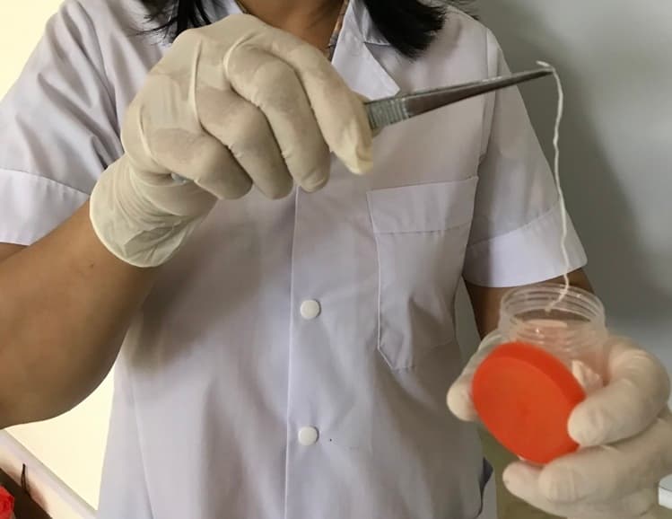 Cảnh báo giun rồng ký sinh dài 1m trong đùi người đàn ông Yên Bái - ảnh 1